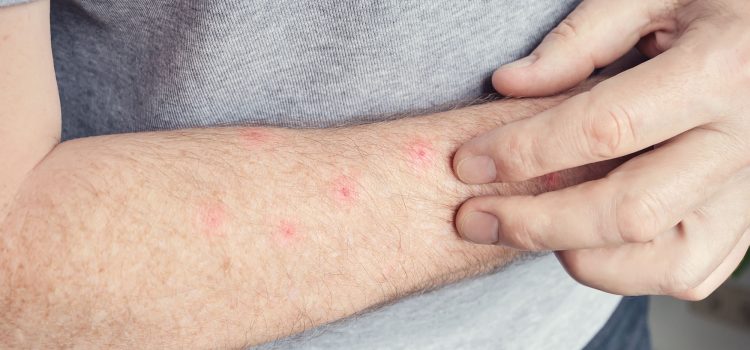 Poisons, Bites, and Stings: Australia’s 24/7 Poisons Line Guide (2026)