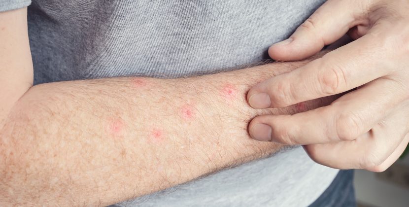 Poisons, Bites, and Stings: Australia's 24/7 Poisons Line Guide (2026)